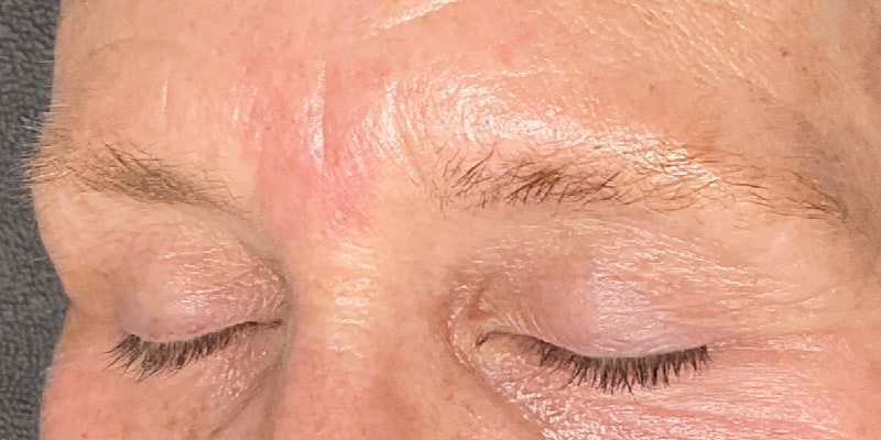Brow Lamination Before & After Image