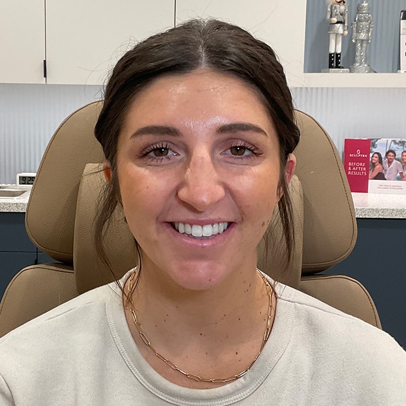 Botox & Dysport Before & After Image