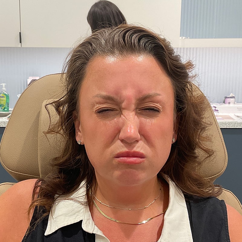 Botox & Dysport Before & After Image