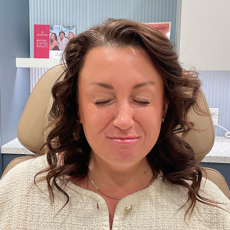 Botox & Dysport Before & After Image