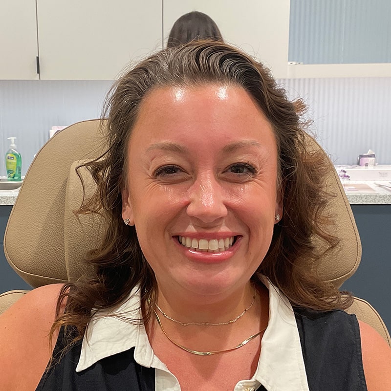 Botox & Dysport Before & After Image