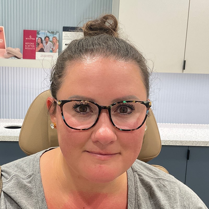 Botox & Dysport Before & After Image