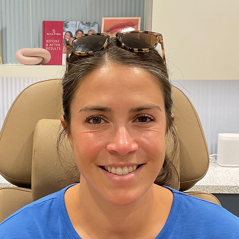 Botox & Dysport Before & After Image