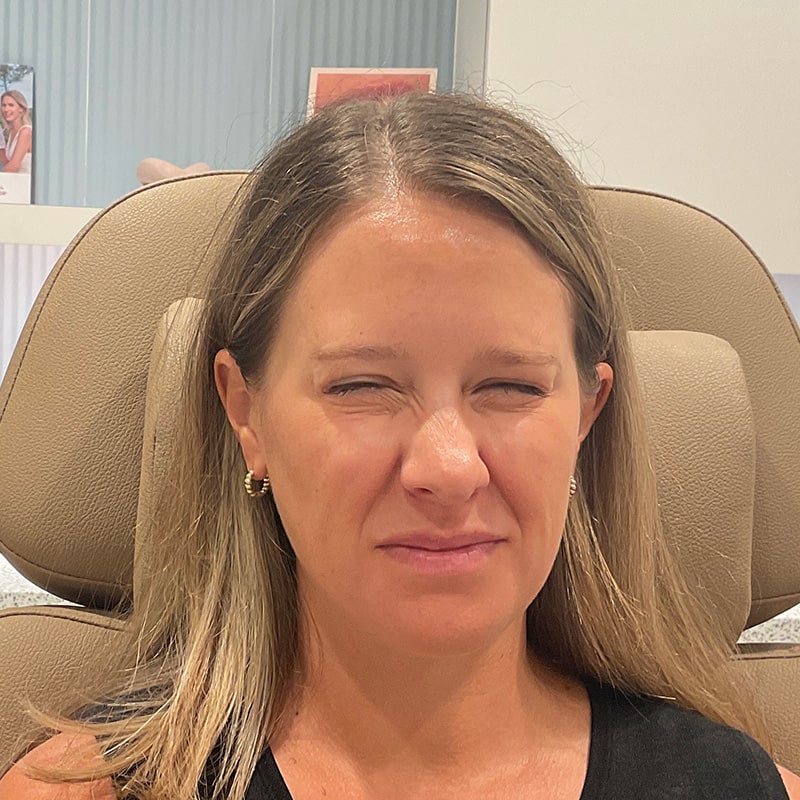 Botox & Dysport Before & After Image