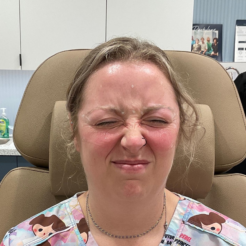 Botox & Dysport Before & After Image