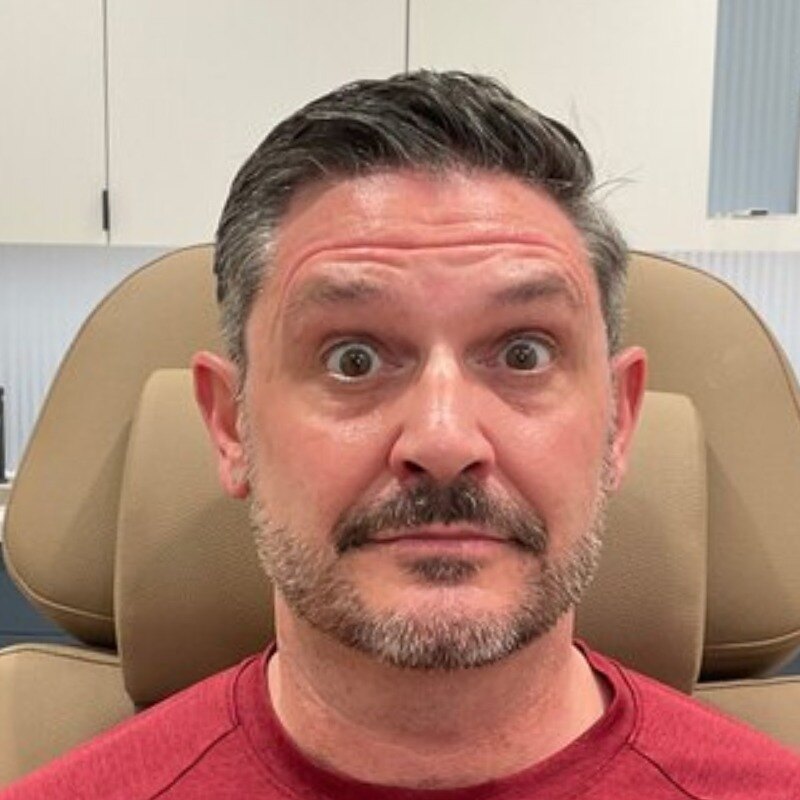 Botox & Dysport Before & After Image