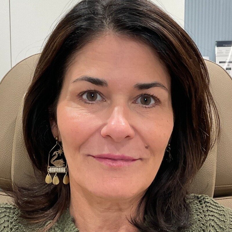 Full Facial Balancing Before & After Image