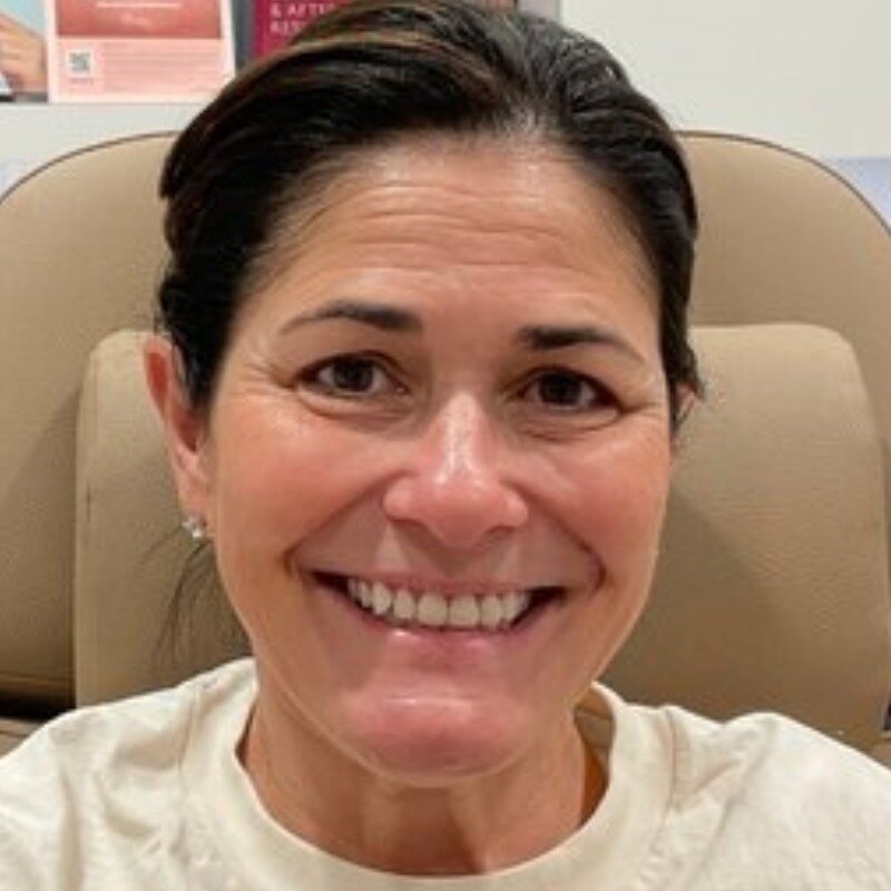 Full Facial Balancing Before & After Image