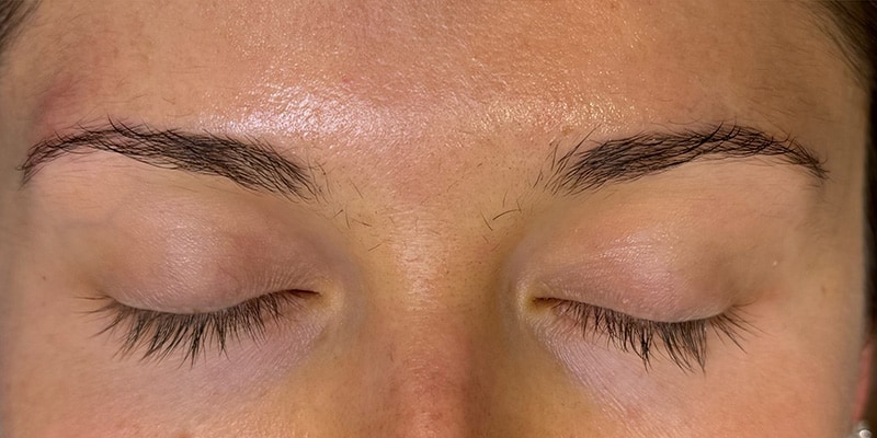 Brow Lamination Before & After Image