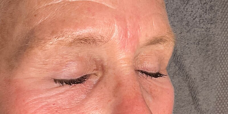 Brow Lamination Before & After Image