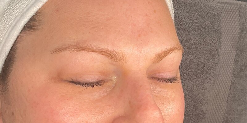 Brow Lamination Before & After Image