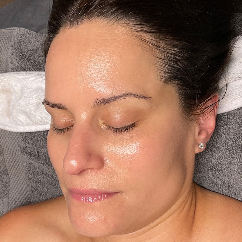 Facials Before & After Image