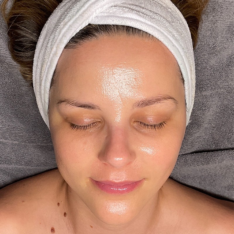 Facials Before & After Image