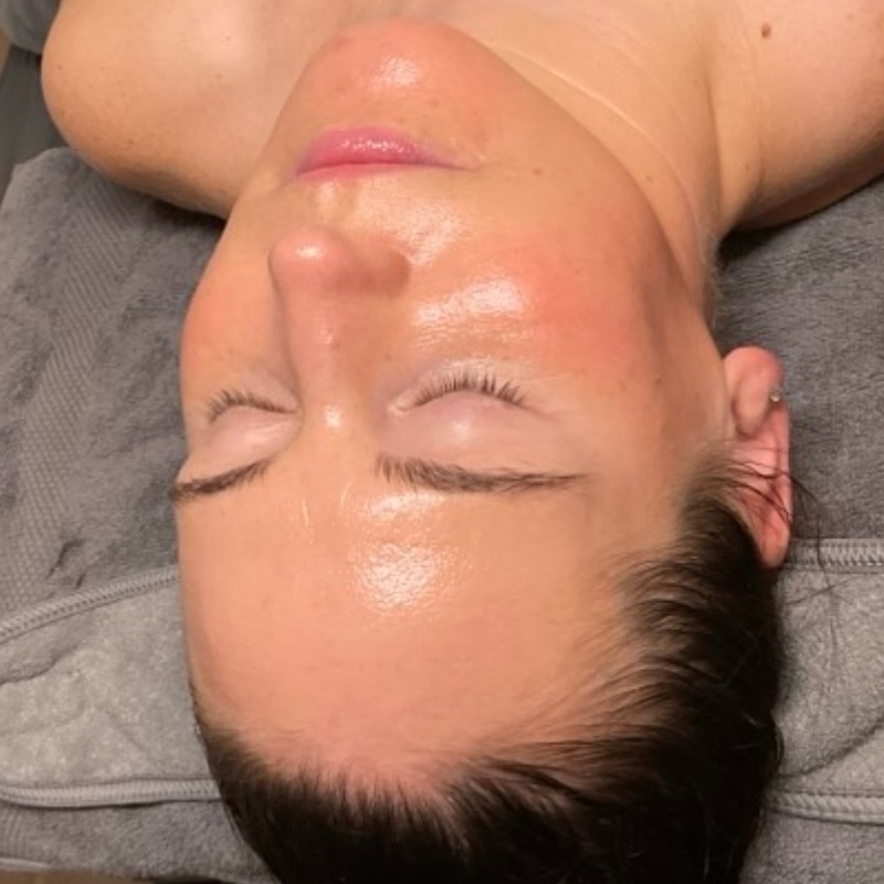 Facials Before & After Image